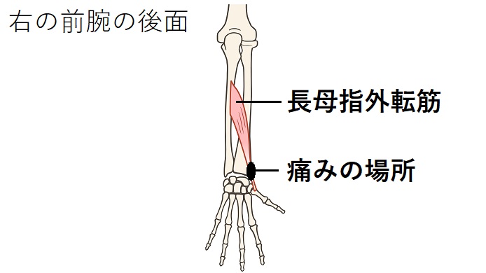 長母指外転筋のイラスト