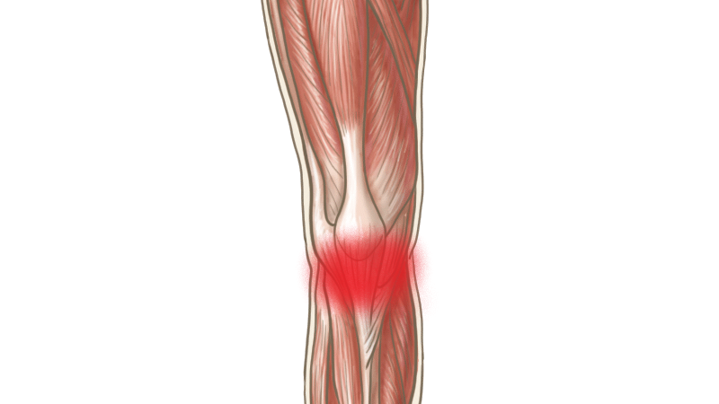 膝の周りの筋肉のイラスト