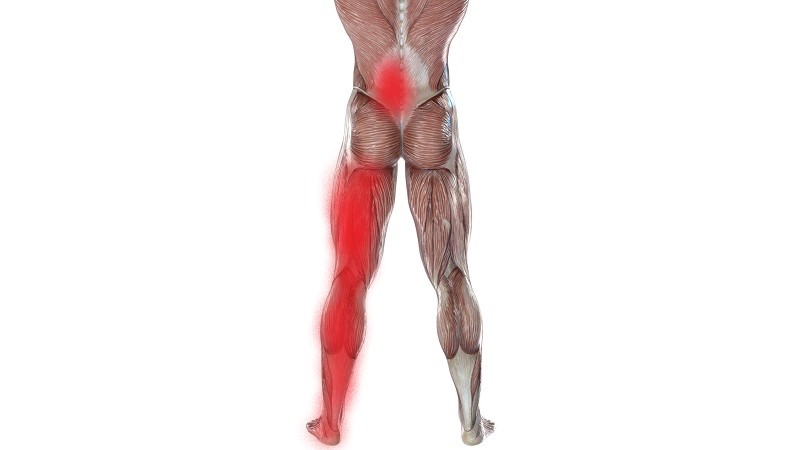 腰痛と足のしびれの筋肉のイラスト