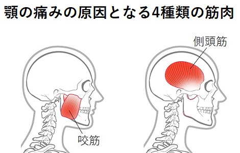 咬筋と側頭筋のイラスト